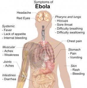 Symptoms_of_ebola